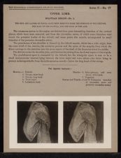 Upper Limb. Scapular Region - no. 1