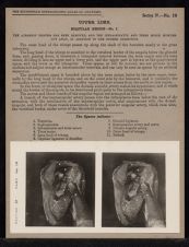 Upper Limb. Scapular Region - no. 3