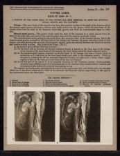 Upper Limb. Back of Arm - no. 1