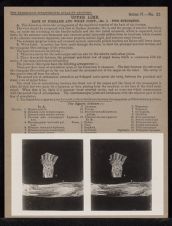 Upper Limb. Back of Forearm and Wrist Joint - no. 1