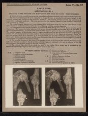 Upper Limb. Articulations - no. 1