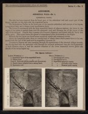 Abdomen. Abdominal Wall - no. 1