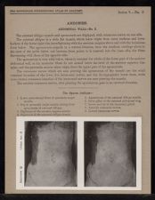 Abdomen. Abdominal Wall - no. 3