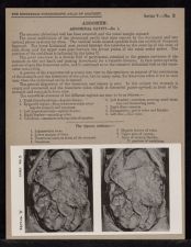 Abdomen. Abdominal Cavity - no. 1