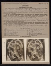 Abdomen. Abdominal Cavity - no. 4