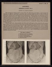 Abdomen. Abdominal Cavity - no. 5