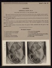 Abdomen. Abdominal Cavity - no. 6