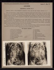 Abdomen. Abdominal Cavity - no. 7