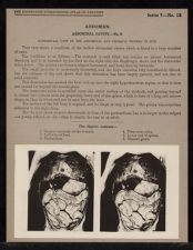 Abdomen. Abdominal Cavity - no. 8