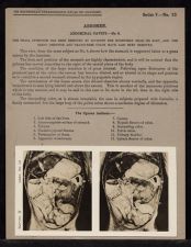 Abdomen. Abdominal Cavity - no. 9