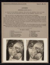 Abdomen. Abdominal Cavity - no. 10