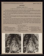 Abdomen. Abdominal Aorta - no. 1