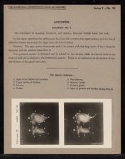 Abdomen. Bladder - no. 3