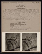 Abdomen. Inguinal Region - no. 1