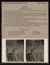 Abdomen. Inguinal Region - no. 3