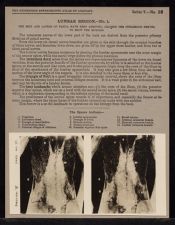 Lumbar Region - no. 1