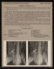 Lumbar Region - no. 2