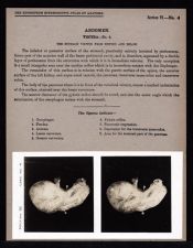 Abdomen. Viscera - no. 4