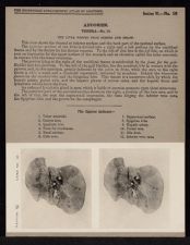 Abdomen. Viscera - no. 10