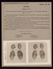 Abdomen. Viscera - no. 15