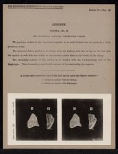 Abdomen. Viscera - no. 19