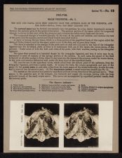 Pelvis. Male Perineum - no. 1