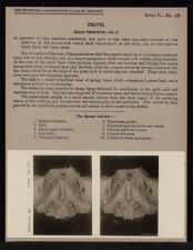 Pelvis. Male Perineum - no. 2