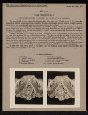 Pelvis. Male Perineum - no. 4