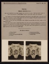 Pelvis. Female Perineum - no. 4