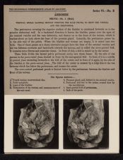 Abdomen. Pelvis - no. 2 (Male)