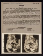 Abdomen. Pelvis - no. 3