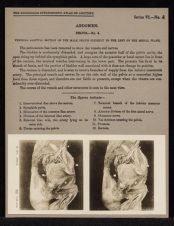 Abdomen. Pelvis - no. 4