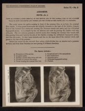 Abdomen. Pelvis - no. 5