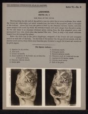 Abdomen. Pelvis - no. 6