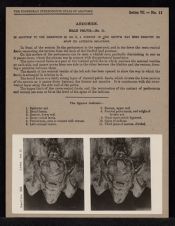 Abdomen. Male Pelvis - no. 11