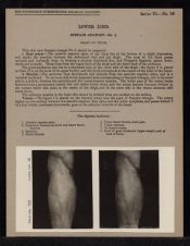 Lower Limb. Surface Anatomy - no. 1