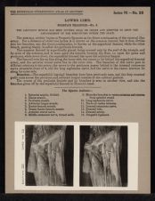 Lower Limb. Scarpa's Triangle - no. 3