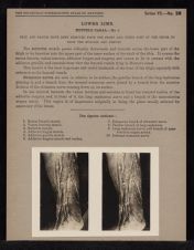 Lower Limb. Hunter's Canal - no. 1