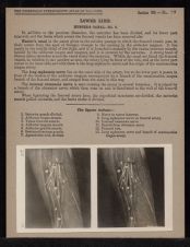 Lower Limb. Hunter's Canal - no. 2