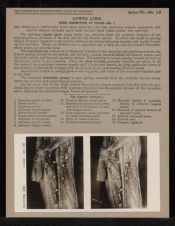 Lower Limb. Deep Dissection of Thigh - no. 1