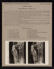 Lower Limb. Deep Dissection of Thigh - no. 2