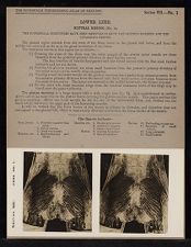 Lower Limb. Gluteal Region - no. 1a