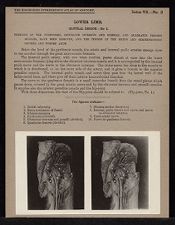 Lower Limb. Gluteal Region - no. 2