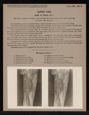 Lower Limb. Back of Thigh - no. 1