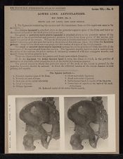 Lower Limb. Articulations. Hip Joint - no. 1