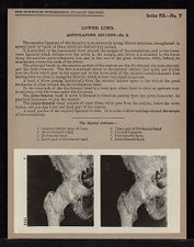 Lower Limb. Articulations. Hip Joint - no. 2