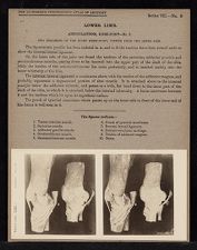 Lower Limb. Articulations. Knee-Joint - no. 2