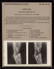 Lower Limb. Articulations. Knee-Joint - no. 3