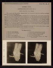 Lower Limb. Articulations. Knee-Joint - no. 4