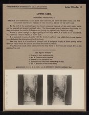 Lower Limb. Popliteal Space - no. 1